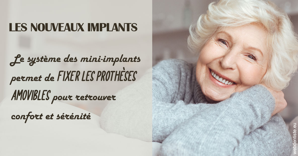 https://dr-corinne-schneider-pigeroulet.chirurgiens-dentistes.fr/Les nouveaux implants 1