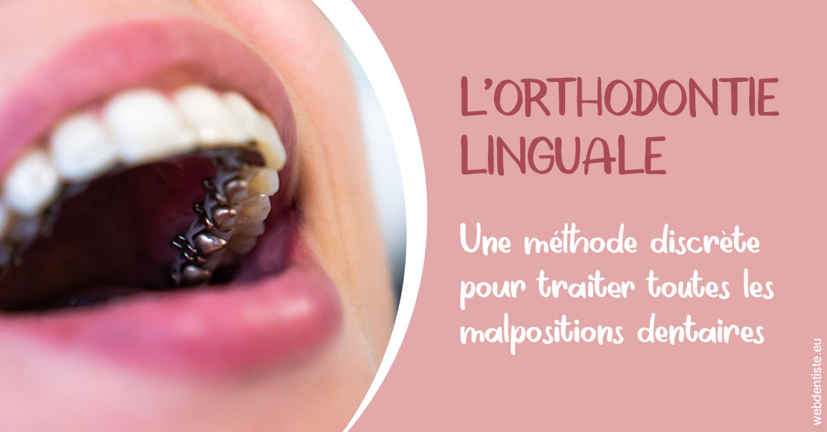 https://dr-corinne-schneider-pigeroulet.chirurgiens-dentistes.fr/L'orthodontie linguale 2