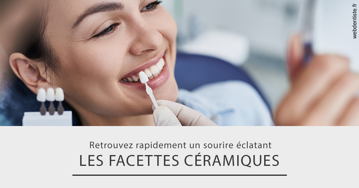 https://dr-corinne-schneider-pigeroulet.chirurgiens-dentistes.fr/Les facettes céramiques 2