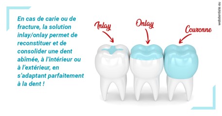 https://dr-corinne-schneider-pigeroulet.chirurgiens-dentistes.fr/L'INLAY ou l'ONLAY