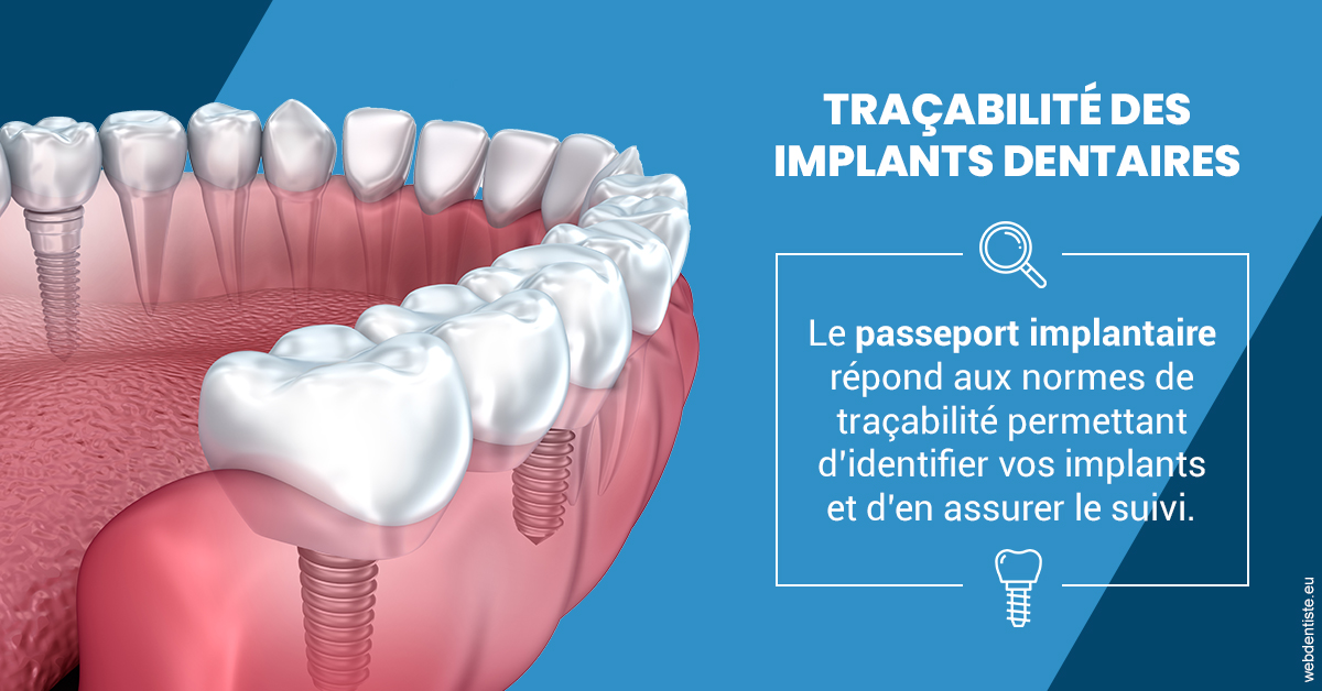 https://dr-corinne-schneider-pigeroulet.chirurgiens-dentistes.fr/T2 2023 - Traçabilité des implants 1