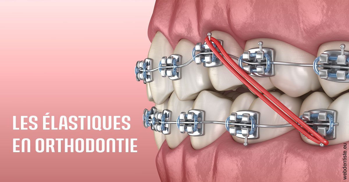 https://dr-corinne-schneider-pigeroulet.chirurgiens-dentistes.fr/Elastiques orthodontie 2