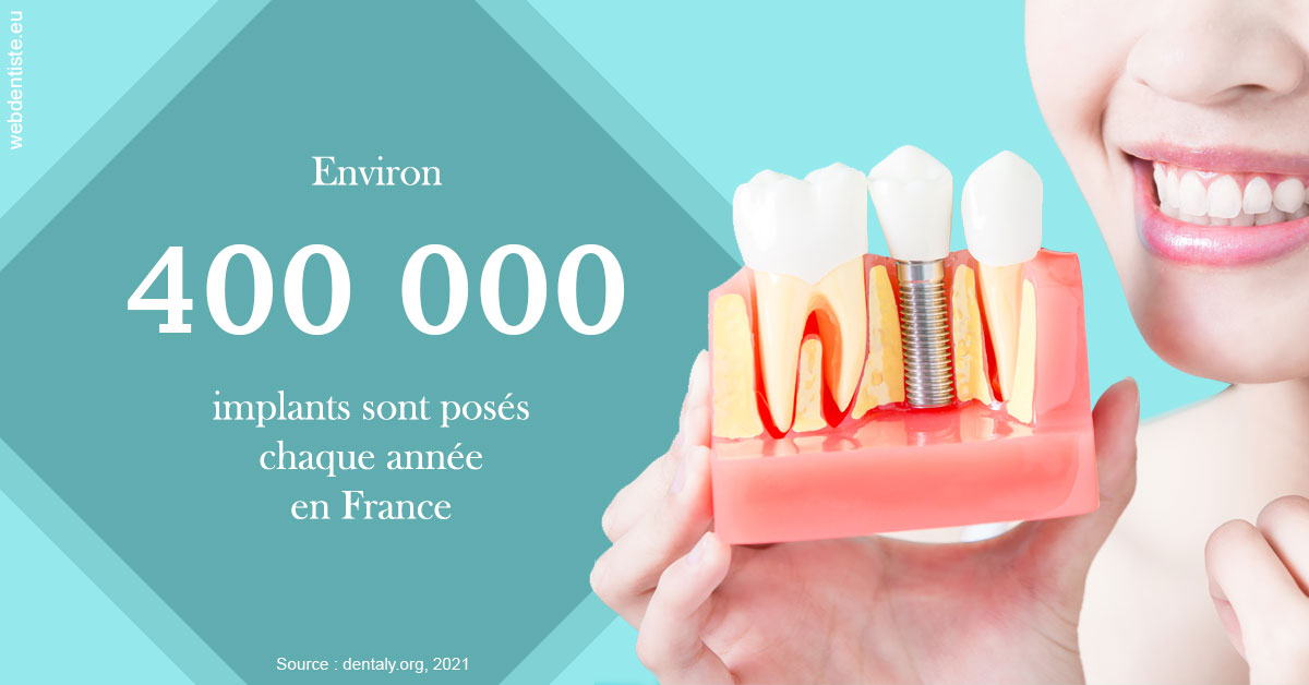 https://dr-corinne-schneider-pigeroulet.chirurgiens-dentistes.fr/Pose d'implants en France 2